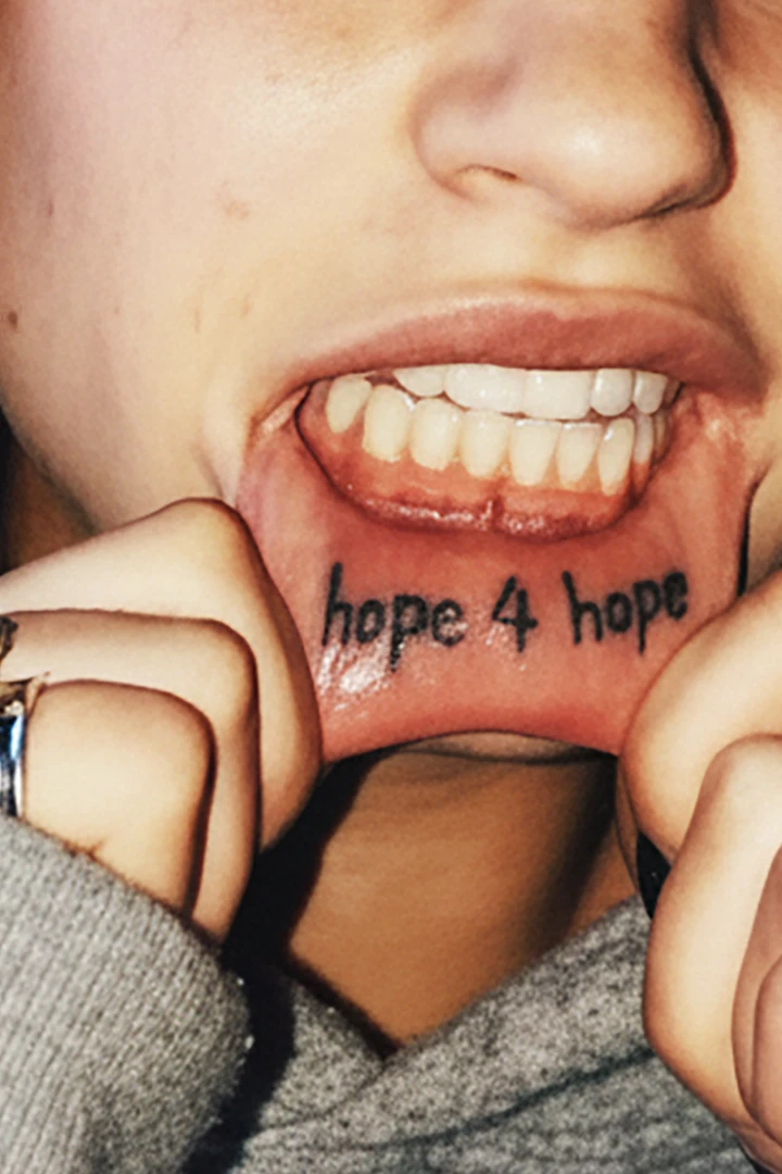 Hope4Hope Exhibition